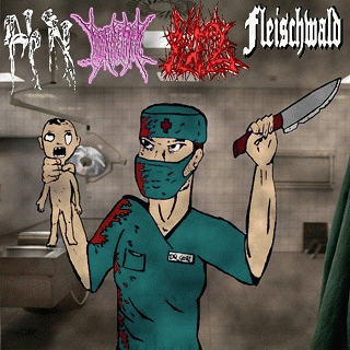 Rektal Fetus : Fleischwald - H1N1 - Rektal Fetus - Furúnculo Anal
